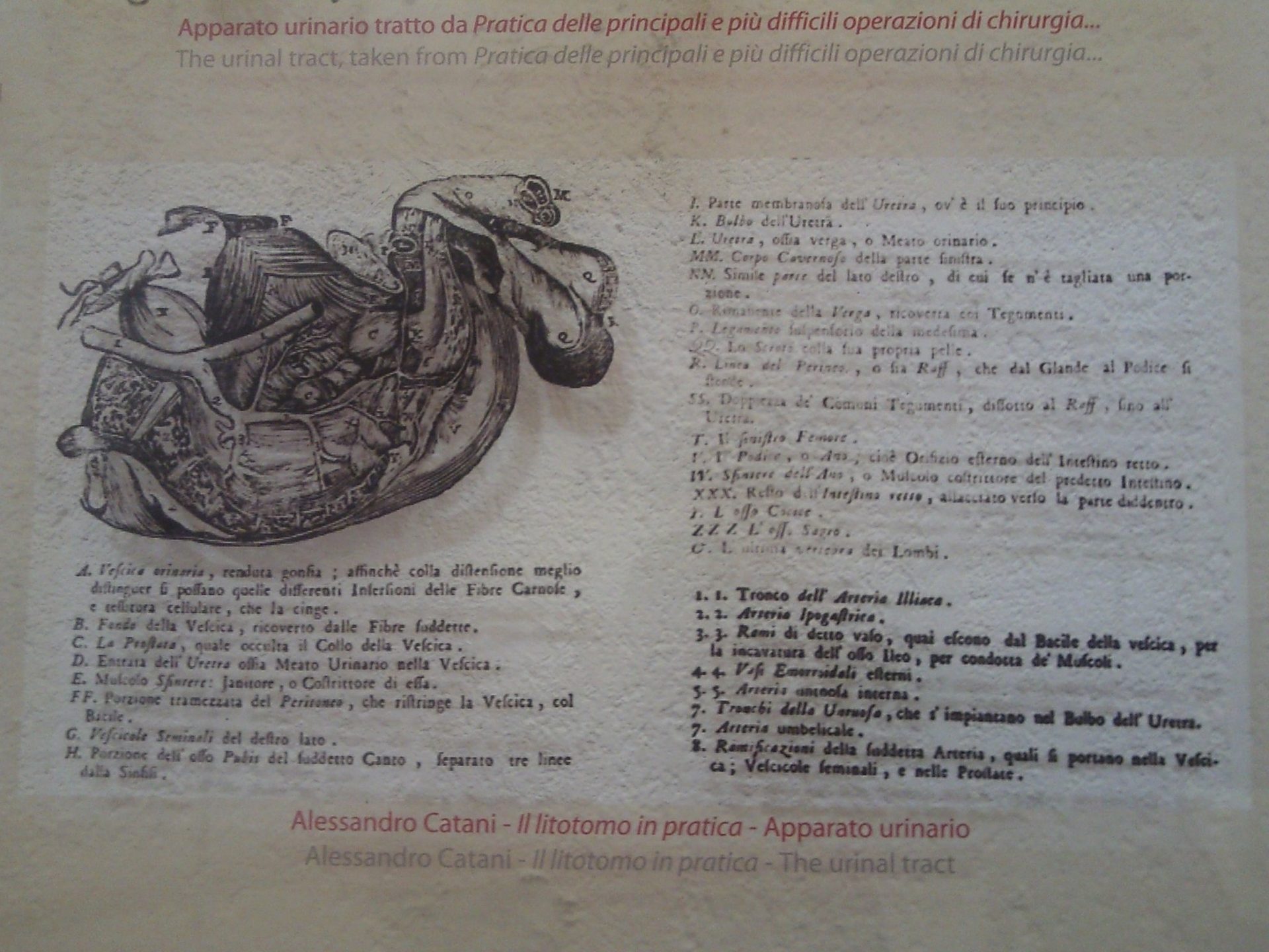 Museo%20chirurgia%20popolare%20Preci12.jpg